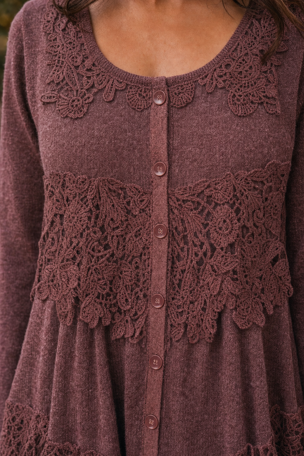 AL-81403 Lace Panel Button-Front Knit Tunic Top or Dress — Embroidery detail